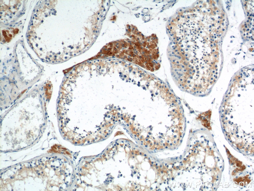 IHC staining of human testis using 13415-1-AP