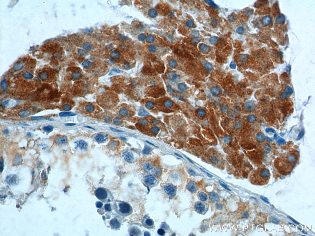 Immunohistochemistry (IHC) staining of human testis tissue using HSD17B3 Polyclonal antibody (13415-1-AP)