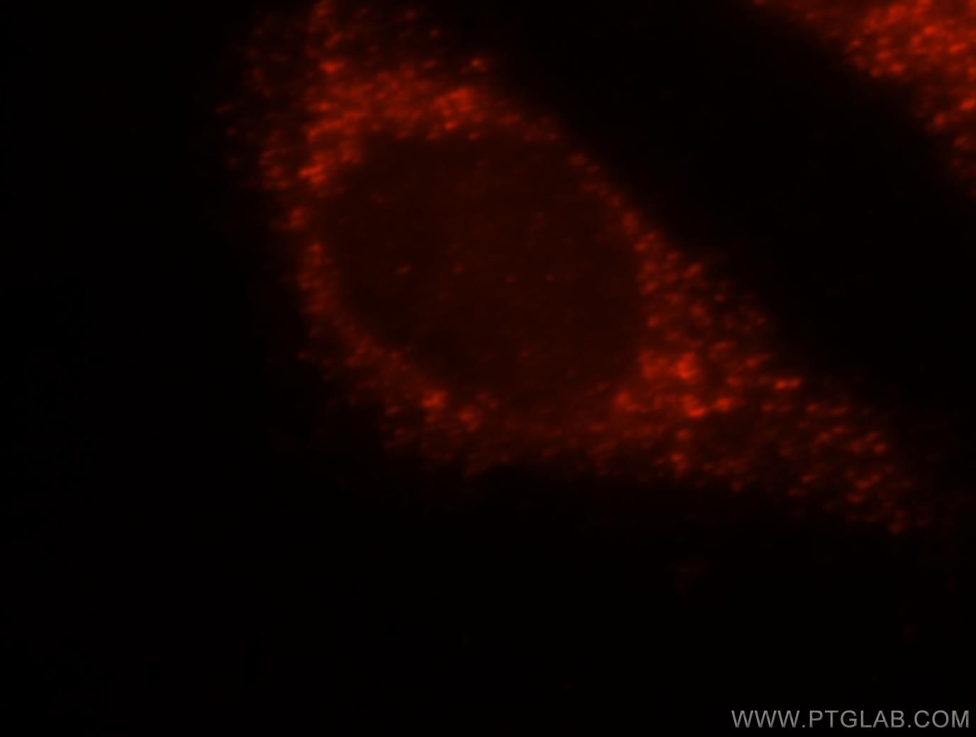 Immunofluorescence (IF) / fluorescent staining of HeLa cells using HSD17B4 Polyclonal antibody (15116-1-AP)