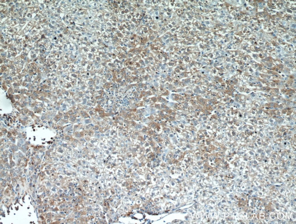 Immunohistochemistry (IHC) staining of mouse liver tissue using HSD17B4 Polyclonal antibody (15116-1-AP)