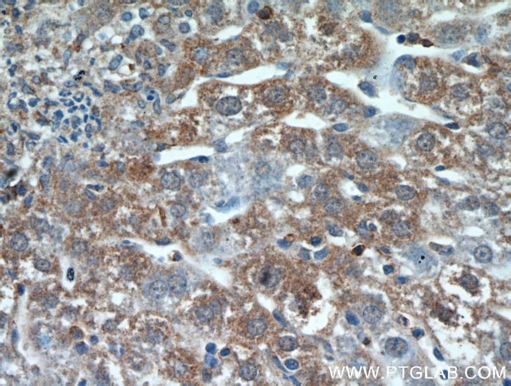Immunohistochemistry (IHC) staining of mouse liver tissue using HSD17B4 Polyclonal antibody (15116-1-AP)