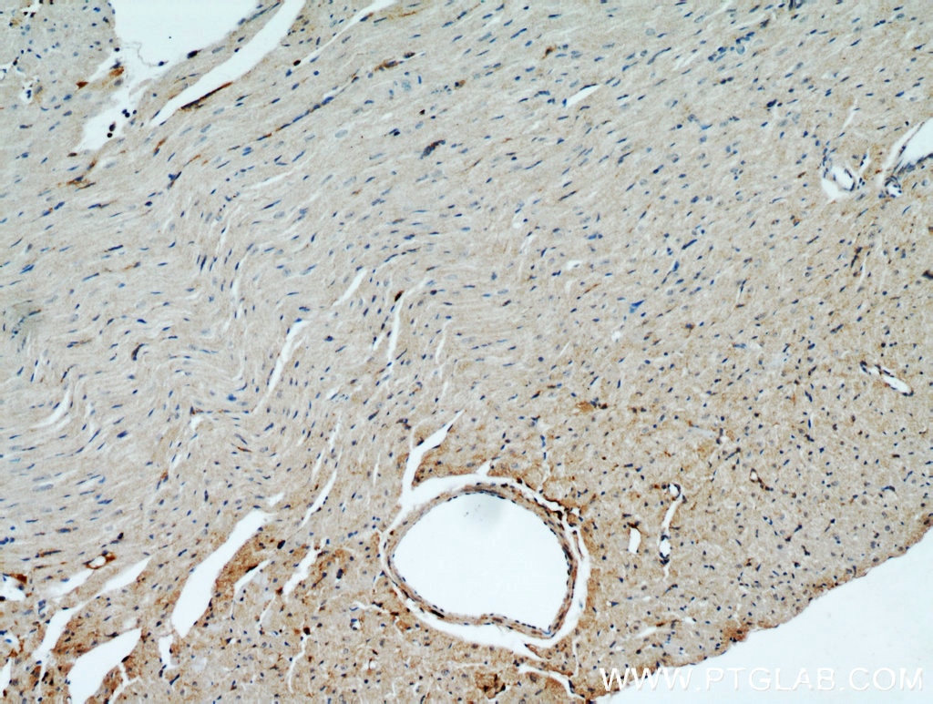 Immunohistochemistry (IHC) staining of mouse heart tissue using HSD17B4 Polyclonal antibody (15116-1-AP)
