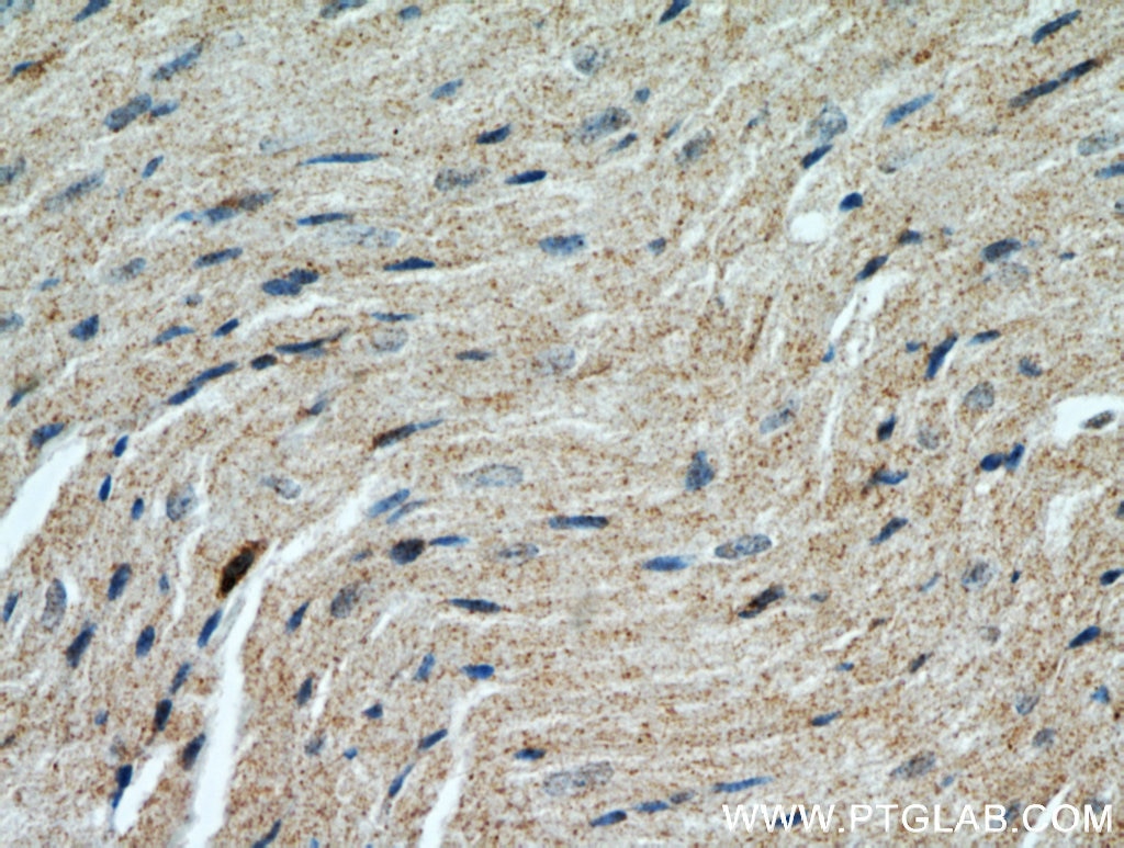 Immunohistochemistry (IHC) staining of mouse heart tissue using HSD17B4 Polyclonal antibody (15116-1-AP)