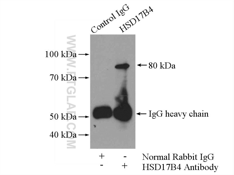Immunoprecipitation (IP) experiment of mouse brain tissue using HSD17B4 Polyclonal antibody (15116-1-AP)