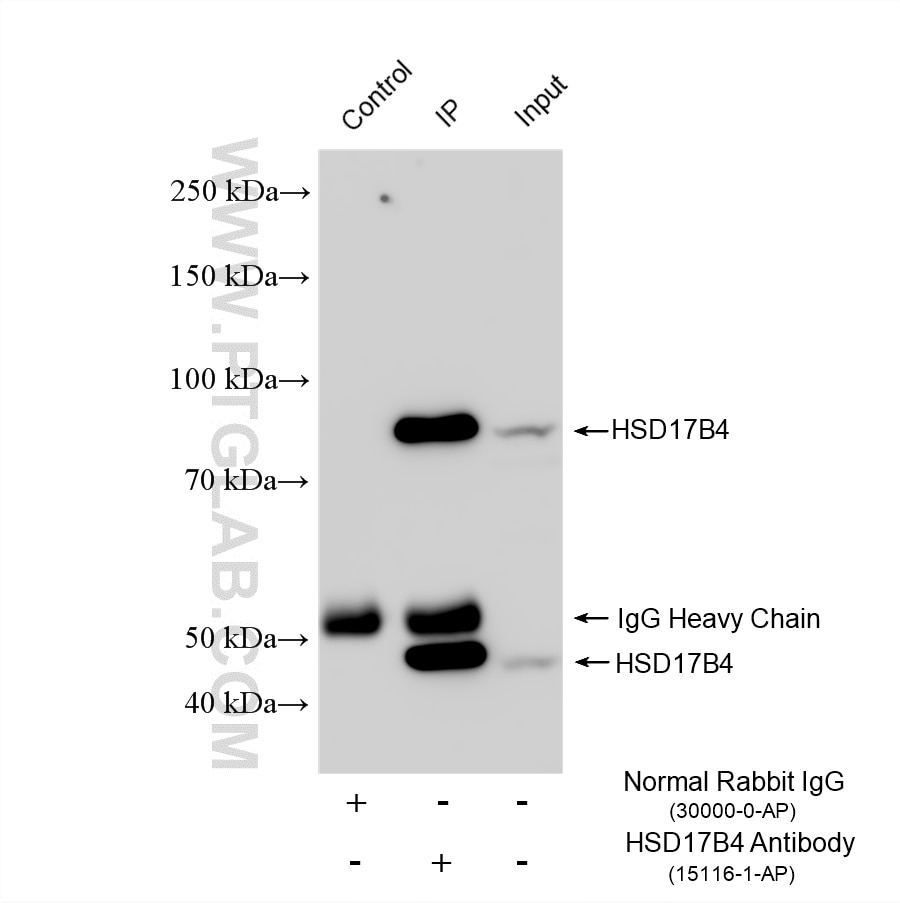 IP experiment of HeLa using 15116-1-AP Immunoprecipitation (IP) experiment of HeLa cells using HSD17B4 Polyclonal antibody (15116-1-AP)