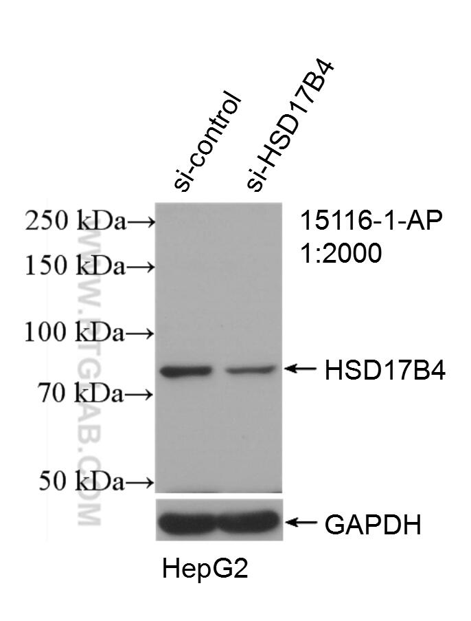 Western Blot (WB) analysis of HepG2 cells using HSD17B4 Polyclonal antibody (15116-1-AP)