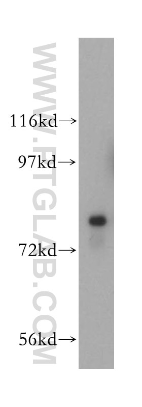 Western Blot (WB) analysis of mouse brain tissue using HSD17B4 Polyclonal antibody (15116-1-AP)
