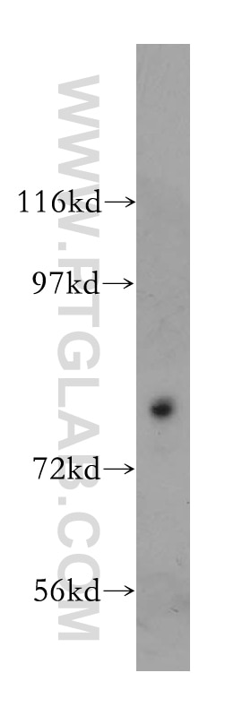 Western Blot (WB) analysis of mouse heart tissue using HSD17B4 Polyclonal antibody (15116-1-AP)