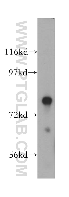 Western Blot (WB) analysis of mouse liver tissue using HSD17B4 Polyclonal antibody (15116-1-AP)