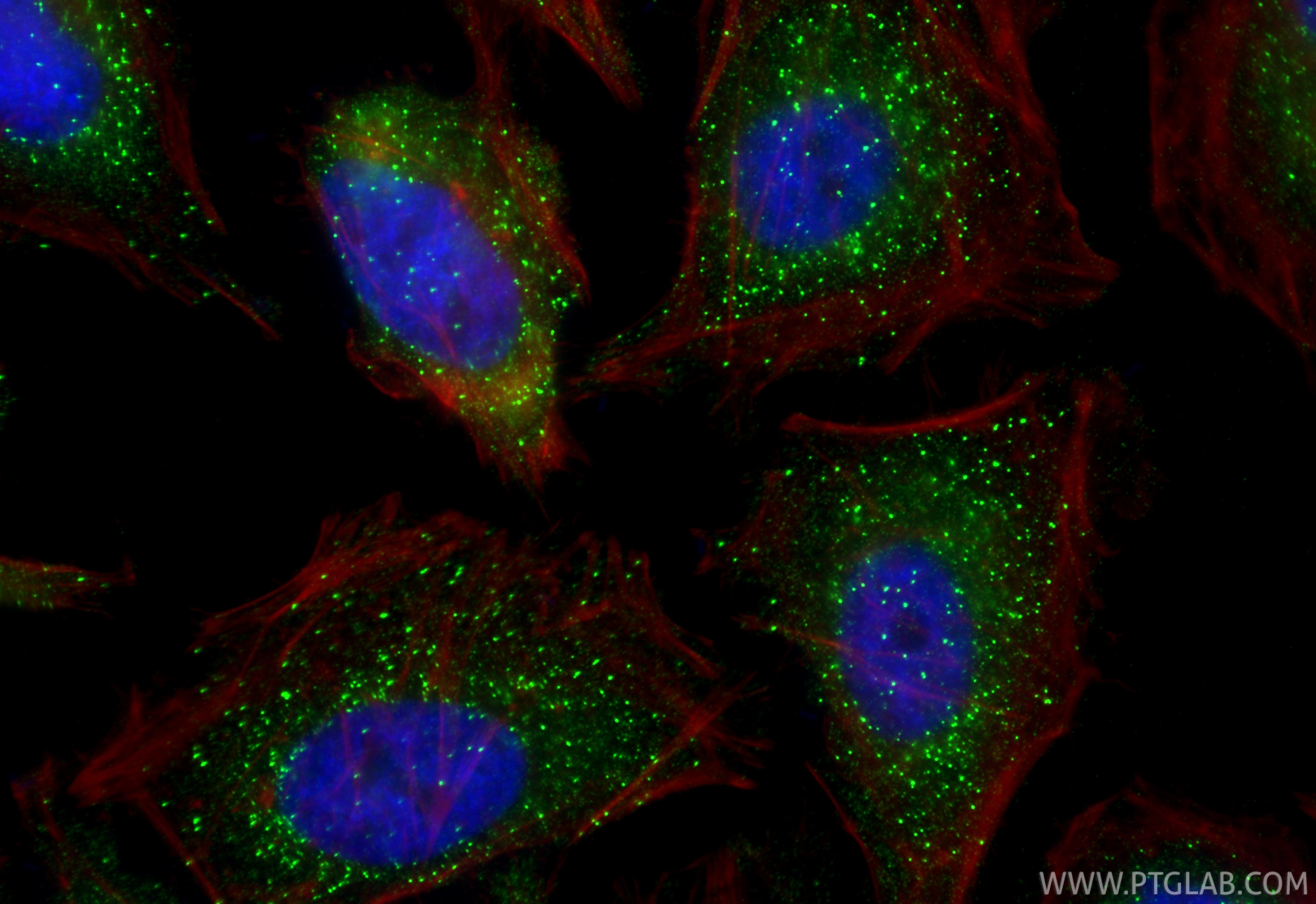 IF Staining of HeLa using 60951-1-Ig (same clone as 60951-1-PBS) Immunofluorescence (IF) / fluorescent staining of HeLa cells using HSD17B4 Monoclonal antibody (60951-1-Ig)