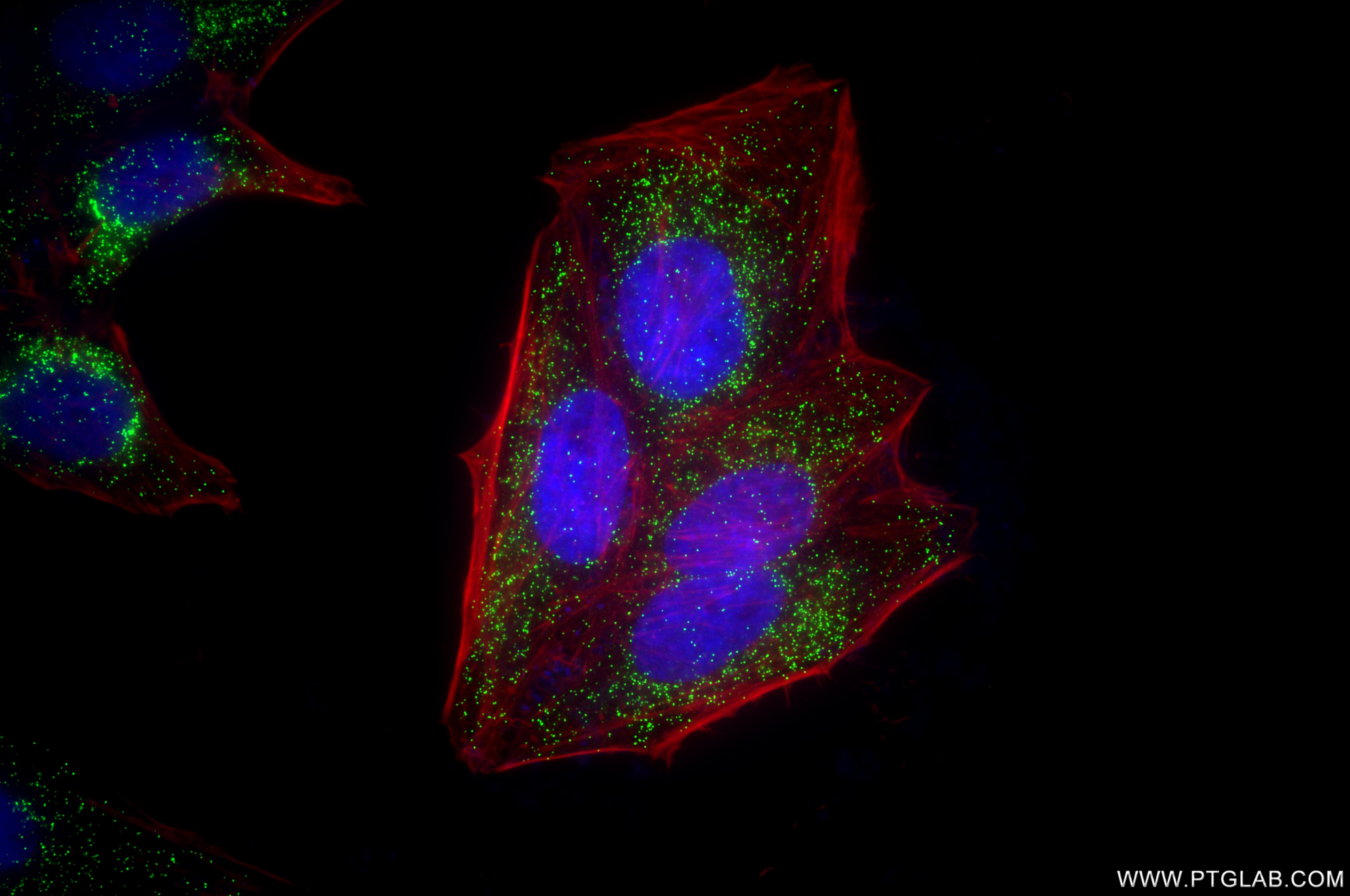 Immunofluorescence (IF) / fluorescent staining of HeLa cells using HSD17B4 Recombinant monoclonal antibody (86334-2-RR)