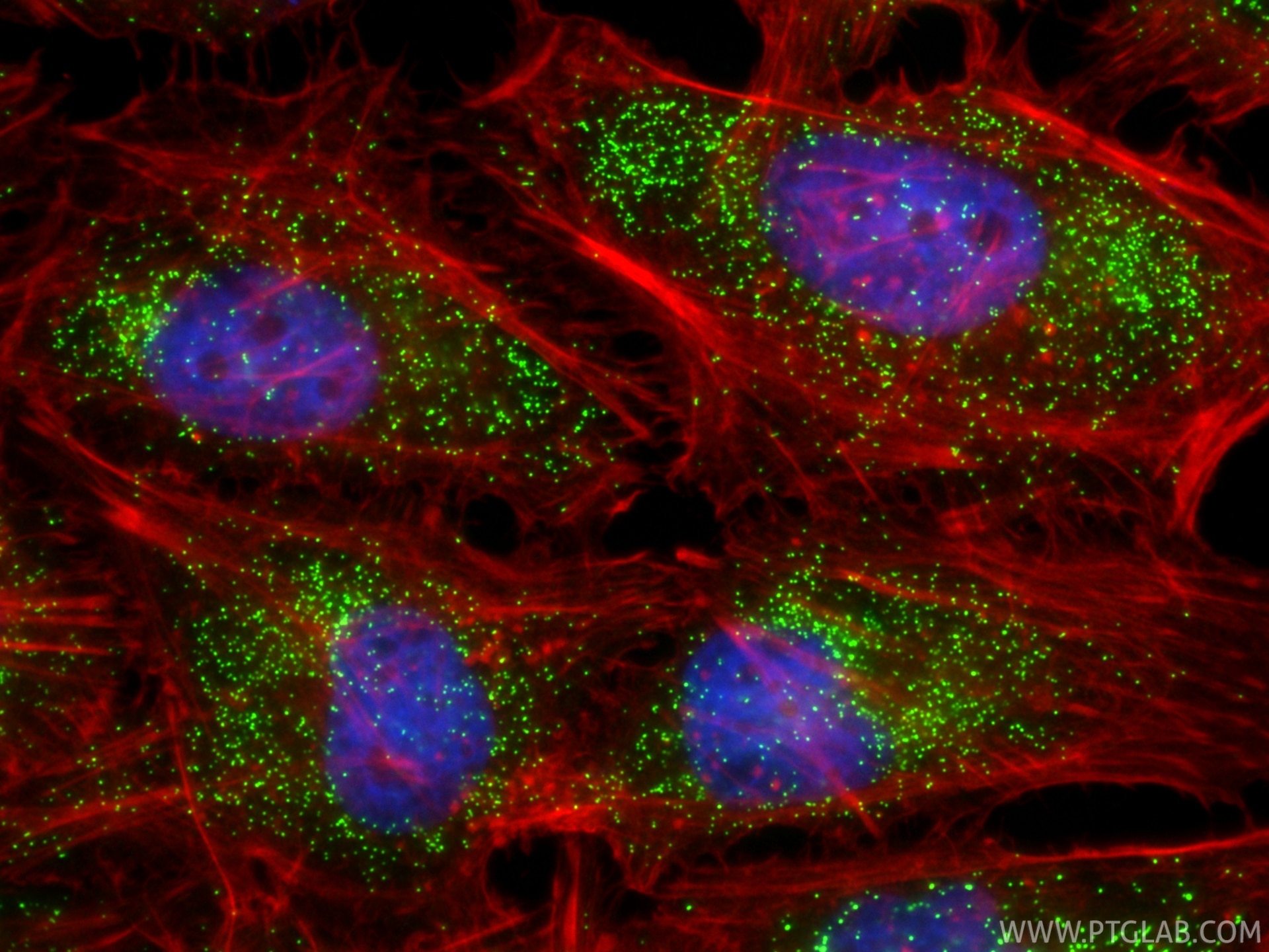 IF Staining of HeLa using 86334-2-RR Immunofluorescence (IF) / fluorescent staining of HeLa cells using HSD17B4 Recombinant monoclonal antibody (86334-2-RR)