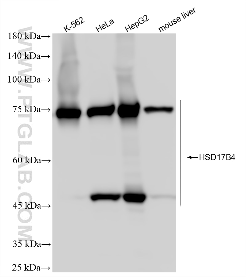 Western Blot (WB) analysis of various lysates using HSD17B4 Recombinant monoclonal antibody (86334-2-RR)