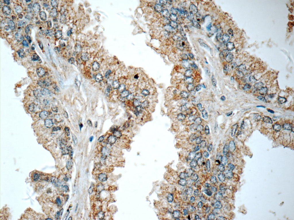 Immunohistochemistry (IHC) staining of human prostate hyperplasia tissue using HSD17B6 Polyclonal antibody (11855-1-AP)