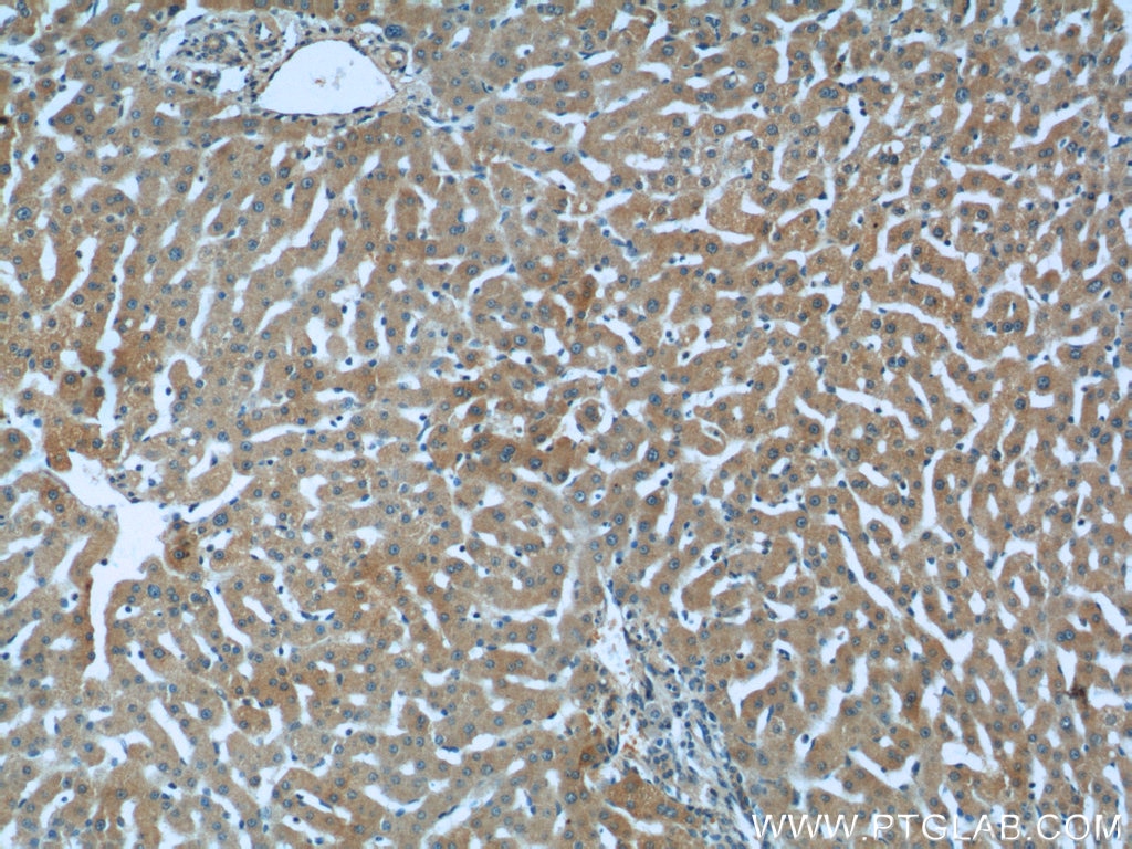 IHC staining of human liver using 11855-1-AP
