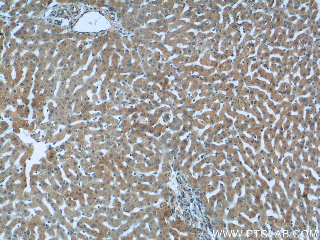 Immunohistochemistry (IHC) staining of human liver tissue using HSD17B6 Polyclonal antibody (11855-1-AP)