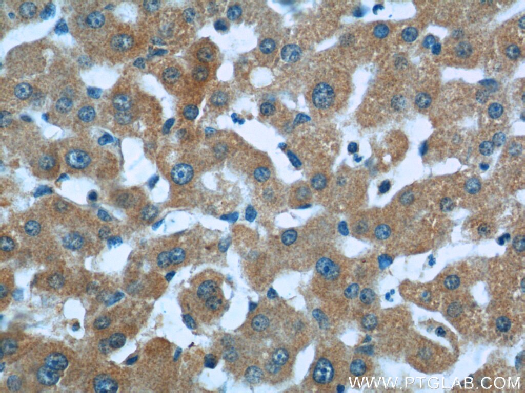 Immunohistochemistry (IHC) staining of human liver tissue using HSD17B6 Polyclonal antibody (11855-1-AP)