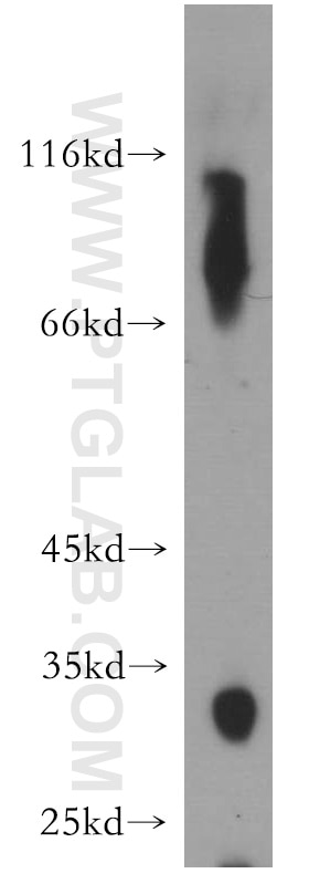 Western Blot (WB) analysis of human liver tissue using HSD17B6 Polyclonal antibody (11855-1-AP)