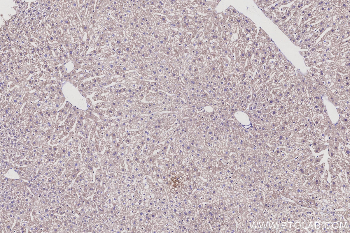 IHC staining of mouse liver using 67496-1-Ig Immunohistochemistry (IHC) staining of mouse liver tissue using HSD17B6 Monoclonal antibody (67496-1-Ig)
