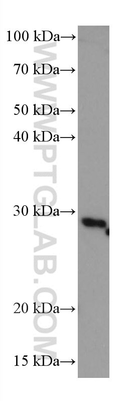 WB analysis of Daudi using 67496-1-Ig