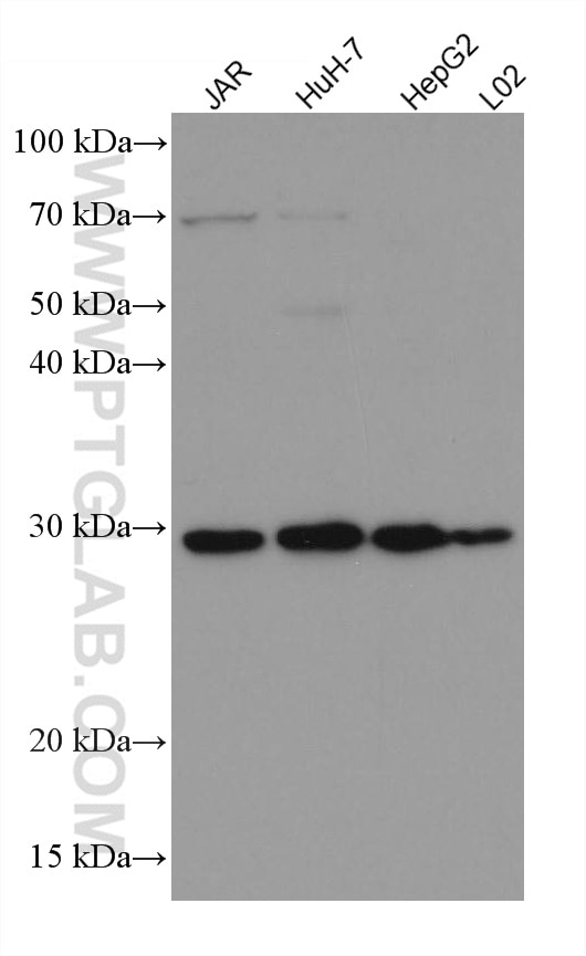 Western Blot (WB) analysis of various lysates using HSD17B6 Monoclonal antibody (67496-1-Ig)