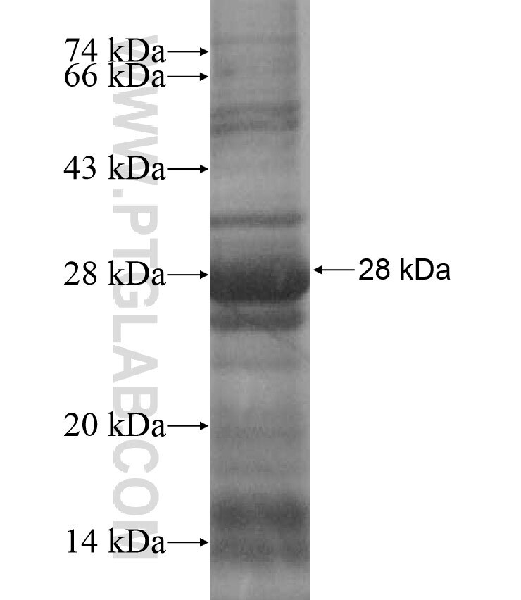 HSD17B6 fusion protein Ag17330 SDS-PAGE