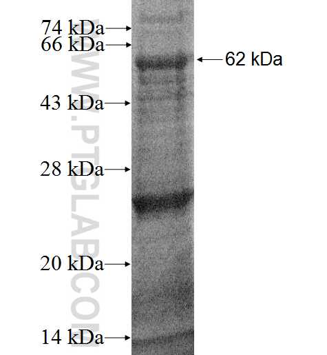 HSD17B6 fusion protein Ag2427 SDS-PAGE