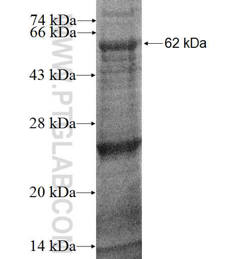 HSD17B6 fusion protein Ag2427 SDS-PAGE