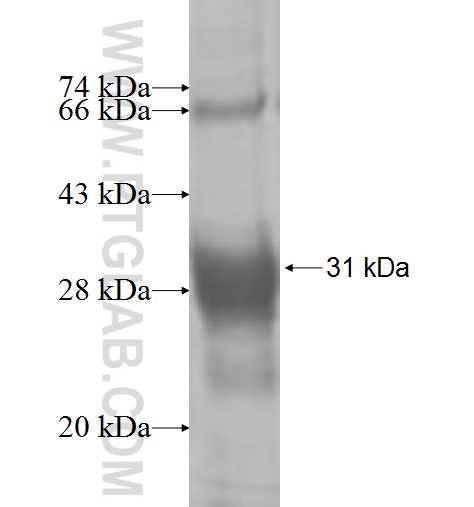 HSD17B7 fusion protein Ag7135 SDS-PAGE