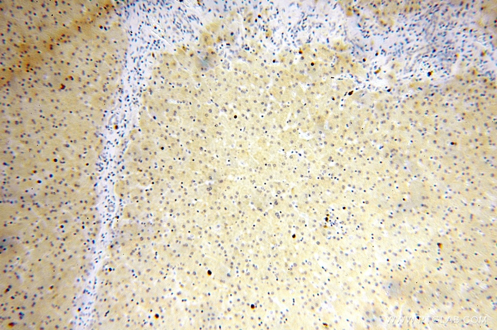 Immunohistochemistry (IHC) staining of human liver tissue using HSD17B7 Polyclonal antibody (16925-1-AP)