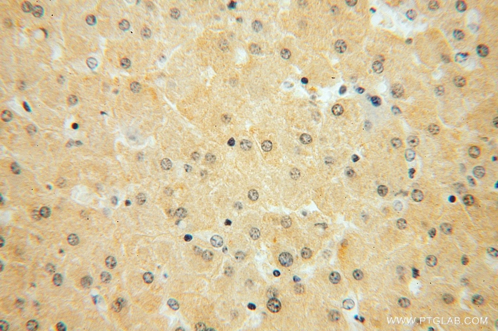 Immunohistochemistry (IHC) staining of human liver tissue using HSD17B7 Polyclonal antibody (16925-1-AP)