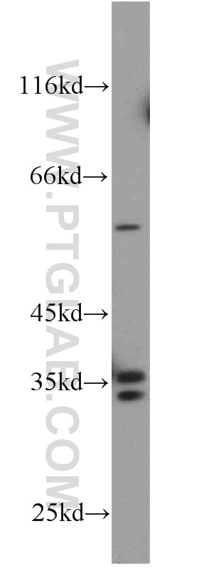 Western Blot (WB) analysis of L02 cells using HSD17B7 Polyclonal antibody (16925-1-AP)