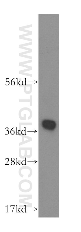 Western Blot (WB) analysis of human liver tissue using HSD17B7 Polyclonal antibody (16925-1-AP)