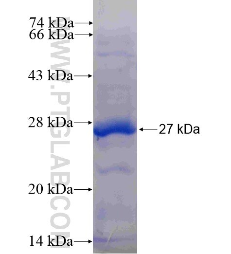 HSD17B7P2 fusion protein Ag10315 SDS-PAGE