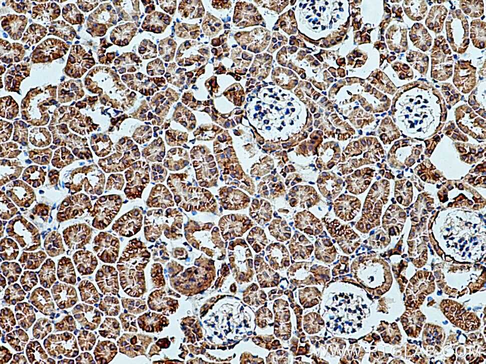 Immunohistochemistry (IHC) staining of mouse kidney tissue using HSD17B8 Polyclonal antibody (16752-1-AP)