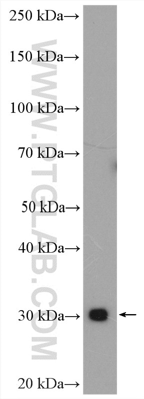 Western Blot (WB) analysis of mouse liver tissue using HSD17B8 Polyclonal antibody (16752-1-AP)