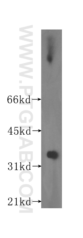 Western Blot (WB) analysis of human testis tissue using HSD17B8 Polyclonal antibody (16752-1-AP)