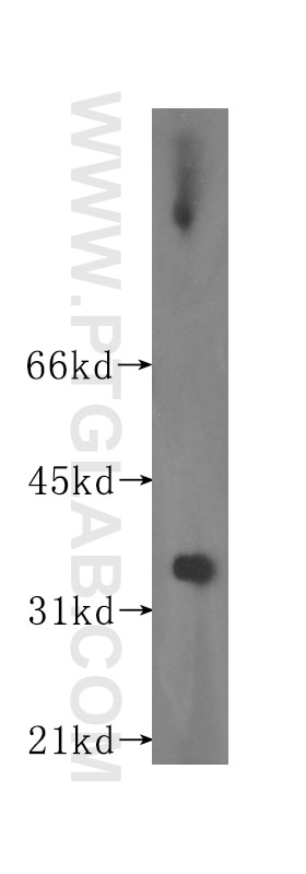 WB analysis of human testis using 16752-1-AP