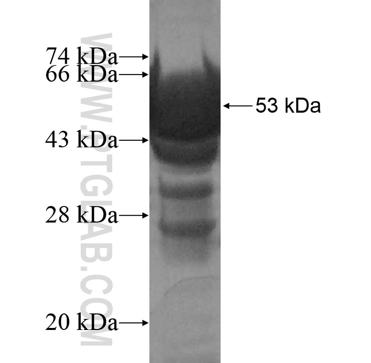 HSD17B8 fusion protein Ag10226 SDS-PAGE