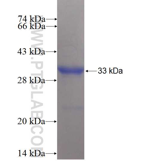 HSD17B8 fusion protein Ag10237 SDS-PAGE