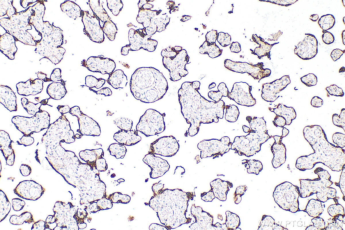 Immunohistochemistry (IHC) staining of human placenta tissue using HSD3B1 Polyclonal antibody (32642-1-AP)