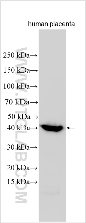 Western Blot (WB) analysis of various lysates using HSD3B1 Polyclonal antibody (32642-1-AP)