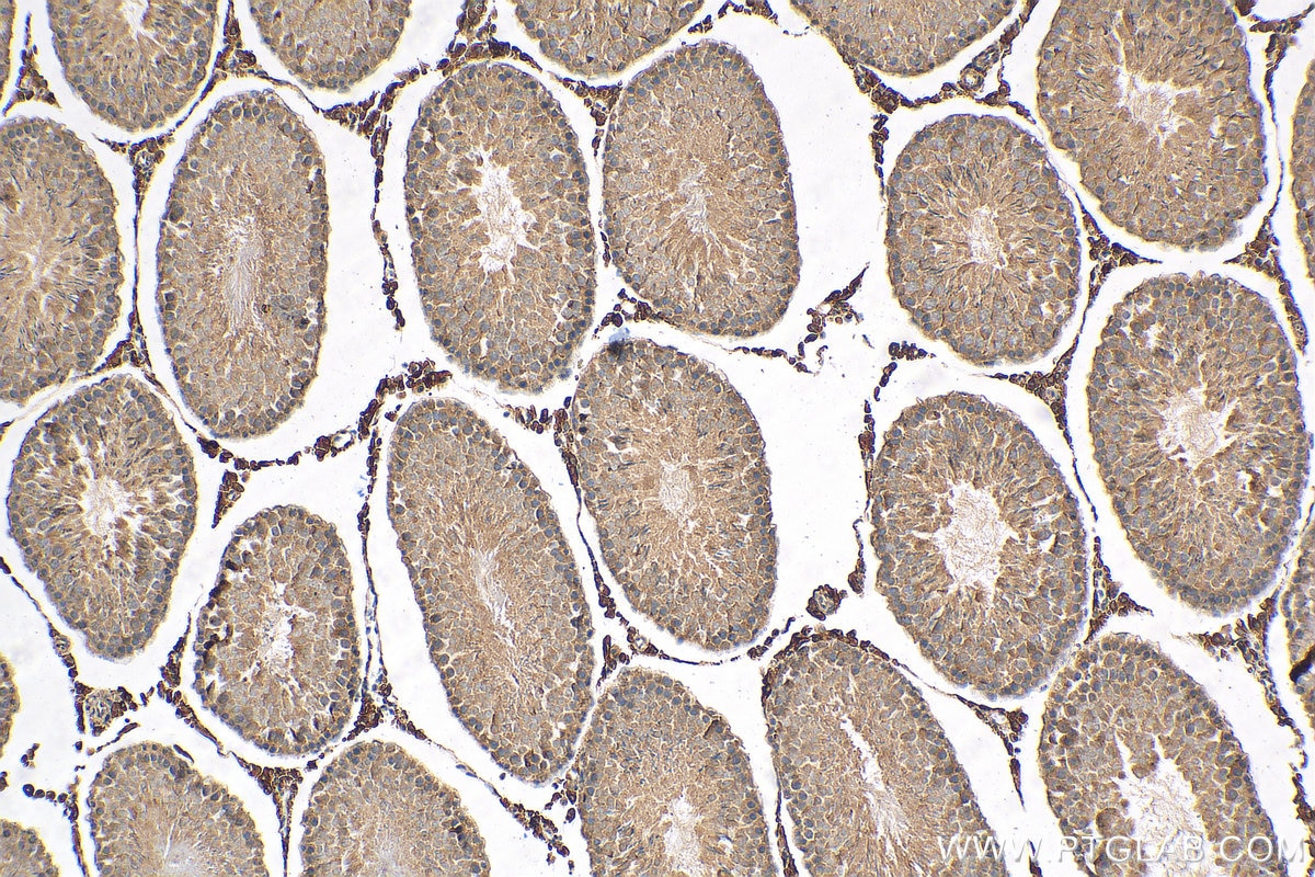 Immunohistochemistry (IHC) staining of rat testis tissue using HSD3B2 Polyclonal antibody (15516-1-AP)