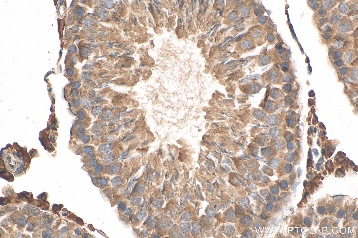 Immunohistochemistry (IHC) staining of rat testis tissue using HSD3B2 Polyclonal antibody (15516-1-AP)