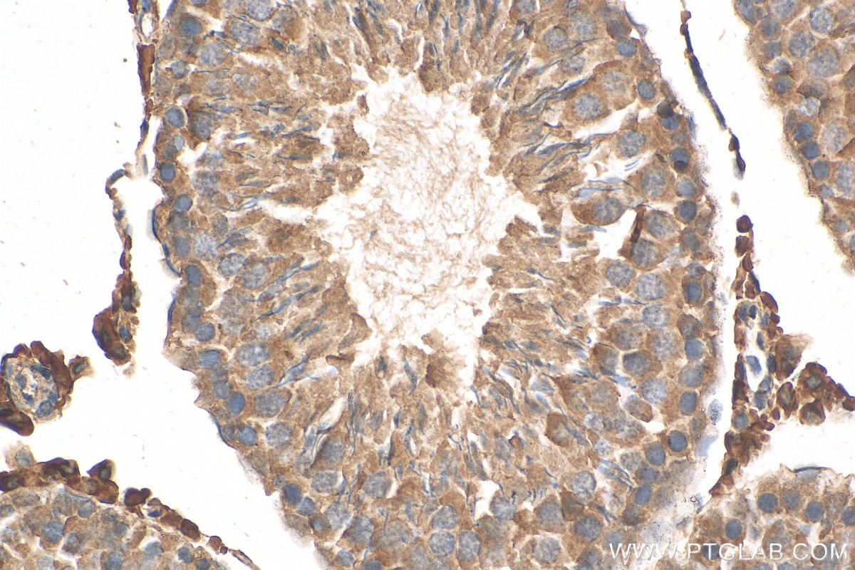 IHC staining of rat testis using 15516-1-AP