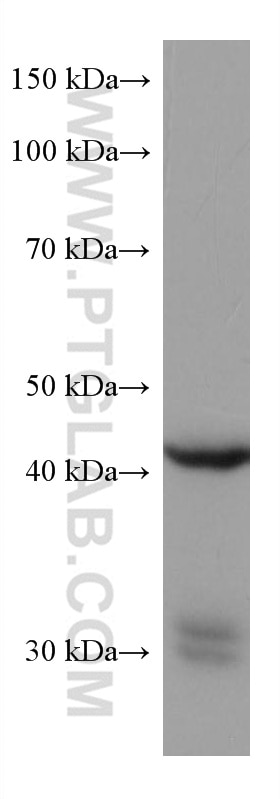 Western Blot (WB) analysis of human placenta tissue using HSD3B2 Monoclonal antibody (67572-1-Ig)