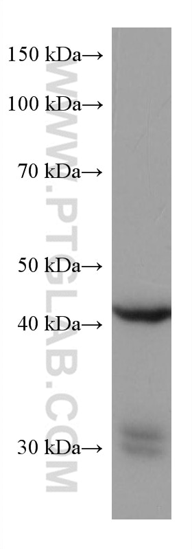 WB analysis of human placenta using 67572-1-Ig