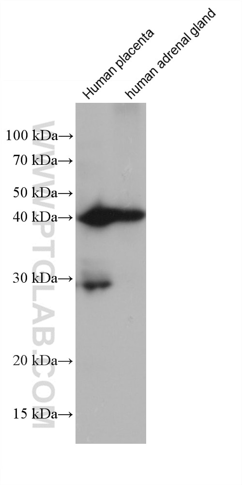 Western Blot (WB) analysis of various lysates using HSD3B2 Monoclonal antibody (67572-1-Ig)