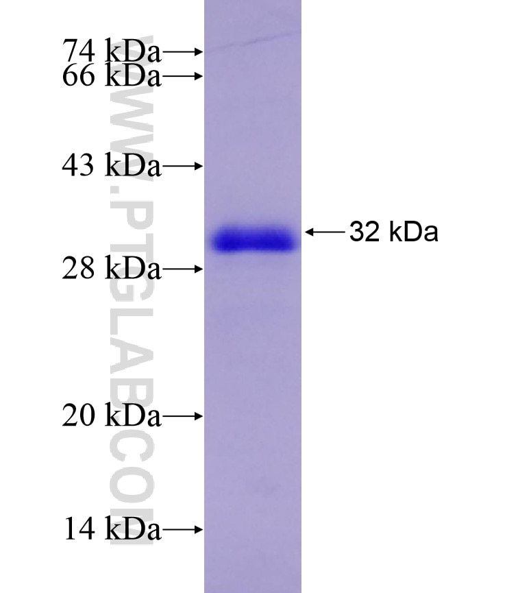 HSD3B2 fusion protein Ag4291 SDS-PAGE