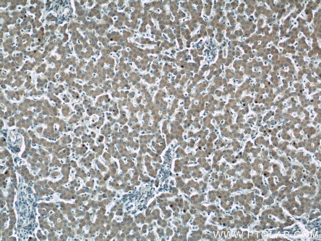 Immunohistochemistry (IHC) staining of human liver tissue using HSD3B7 Polyclonal antibody (10488-1-AP)